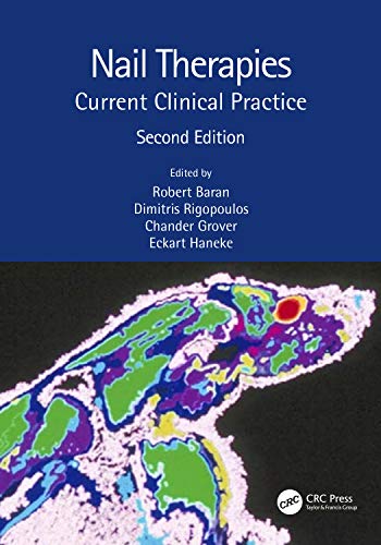 Nail Therapies: Current Clinical Practice, 2nd Edition (Original PDF from Publisher)