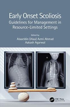 Early Onset Scoliosis: Guidelines for Management in Resource-Limited Settings (Original PDF from Publisher)