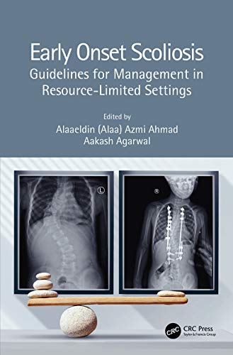 Early Onset Scoliosis: Guidelines for Management in Resource-Limited Settings (Original PDF from Publisher)