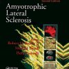 Amyotrophic Lateral Sclerosis, Second Edition (Original PDF from Publisher)