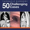 Thoracic Surgery: 50 Challenging cases (Original PDF from Publisher)