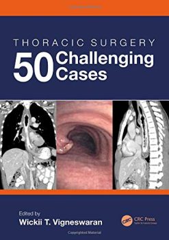 Thoracic Surgery: 50 Challenging cases (Original PDF from Publisher)