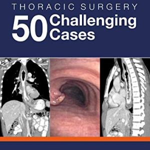 Thoracic Surgery: 50 Challenging cases (Original PDF from Publisher)