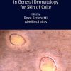 Dermoscopy in General Dermatology for Skin of Color (Original PDF from Publisher)