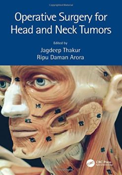 Operative Surgery for Head and Neck Tumors (Original PDF from Publisher)