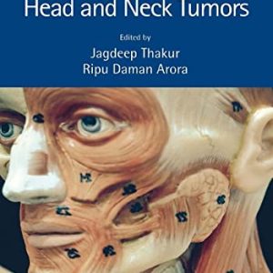 Operative Surgery for Head and Neck Tumors (Original PDF from Publisher)