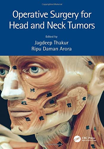 Operative Surgery for Head and Neck Tumors (Original PDF from Publisher)