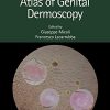 Atlas of Genital Dermoscopy (Original PDF from Publisher)