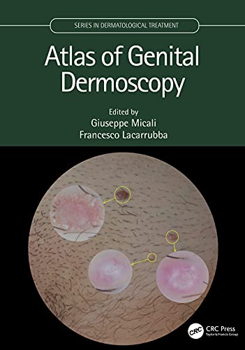 Atlas of Genital Dermoscopy (Original PDF from Publisher)