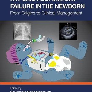 Hypoxic Respiratory Failure in the Newborn: From Origins to Clinical Management (Original PDF from Publisher)