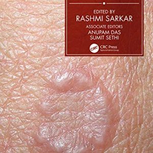 Concise Dermatology (Original PDF from Publisher)