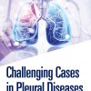 Challenging Cases in Pleural Diseases (EPUB)