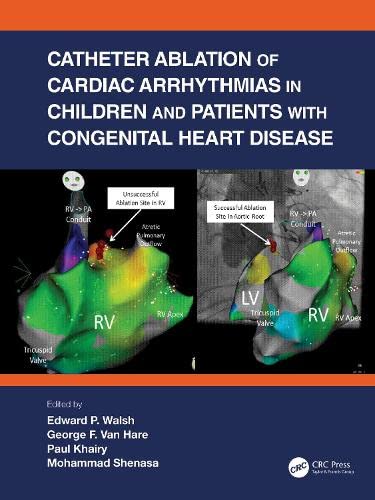 Catheter Ablation of Cardiac Arrhythmias in Children and Patients with Congenital Heart Disease (Original PDF from Publisher)