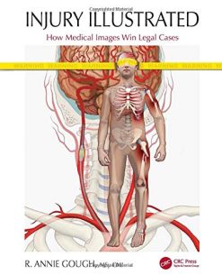 Injury Illustrated: How Medical Images Win Legal Cases (Original PDF from Publisher)