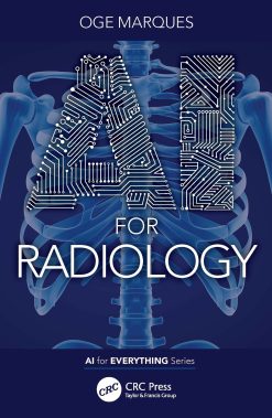 AI for Radiology (EPUB)