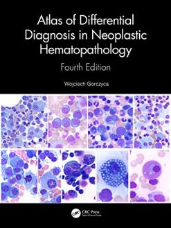 Atlas of Differential Diagnosis in Neoplastic Hematopathology, 4th Edition (Original PDF from Publisher)