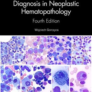 Atlas of Differential Diagnosis in Neoplastic Hematopathology, 4th Edition (Original PDF from Publisher)
