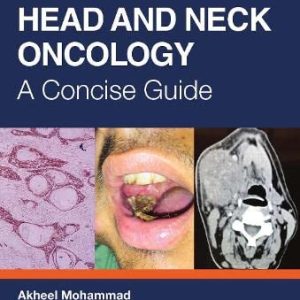 Head and Neck Oncology: A Concise Guide (Original PDF from Publisher)