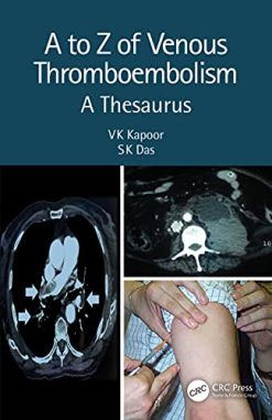 A to Z of Venous Thromboembolism: A Thesaurus (Original PDF from Publisher)