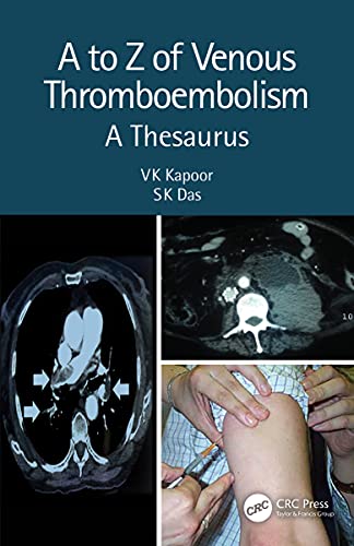 A to Z of Venous Thromboembolism: A Thesaurus (Original PDF from Publisher)