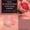 Combination Facial Reconstruction after Mohs Surgery (EPUB)