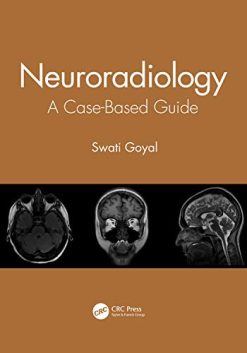 Neuroradiology: A Case-Based Guide (Original PDF from Publisher)