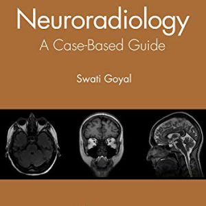 Neuroradiology: A Case-Based Guide (Original PDF from Publisher)