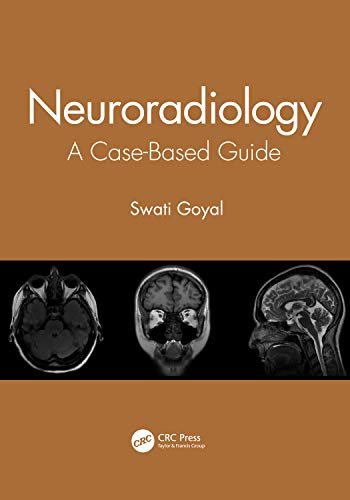 Neuroradiology: A Case-Based Guide (Original PDF from Publisher)