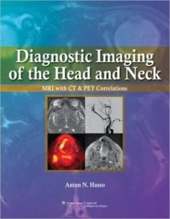 Diagnostic Imaging of the Head and Neck: MRI with CT & PET Correlations (High Quality PDF)