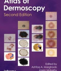 An Atlas of Dermoscopy, 2nd Edition
