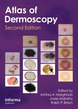 An Atlas of Dermoscopy, 2nd Edition