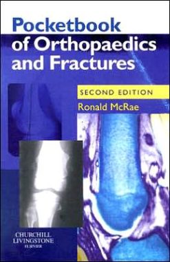 Pocketbook of Orthopaedics and Fractures, 2nd Edition