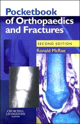 Pocketbook of Orthopaedics and Fractures, 2nd Edition