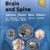 ExpertDDx: Brain and Spine, 3rd Edition (Original PDF from Publisher)