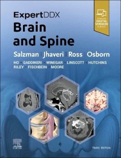 ExpertDDx: Brain and Spine, 3rd Edition (Original PDF from Publisher)