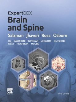 ExpertDDx: Brain and Spine, 3rd Edition (EPUB)