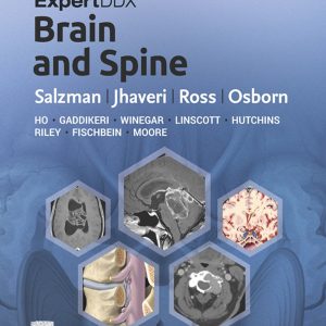 ExpertDDx: Brain and Spine, 3rd Edition (EPUB)