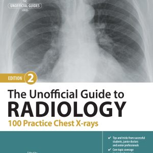 The Unofficial Guide to Radiology: 100 Practice Chest X-rays, 2nd Edition (EPUB)