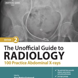 The Unofficial Guide to Radiology: 100 Practice Abdominal X-rays, 2nd Edition (EPUB)