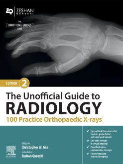 The Unofficial Guide to Radiology: 100 Practice Orthopaedic X-rays, 2nd Edition (EPUB)