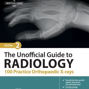 The Unofficial Guide to Radiology: 100 Practice Orthopaedic X-rays, 2nd Edition (EPUB)