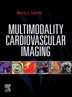 Multimodal Cardiac Imaging (Original PDF from Publisher)