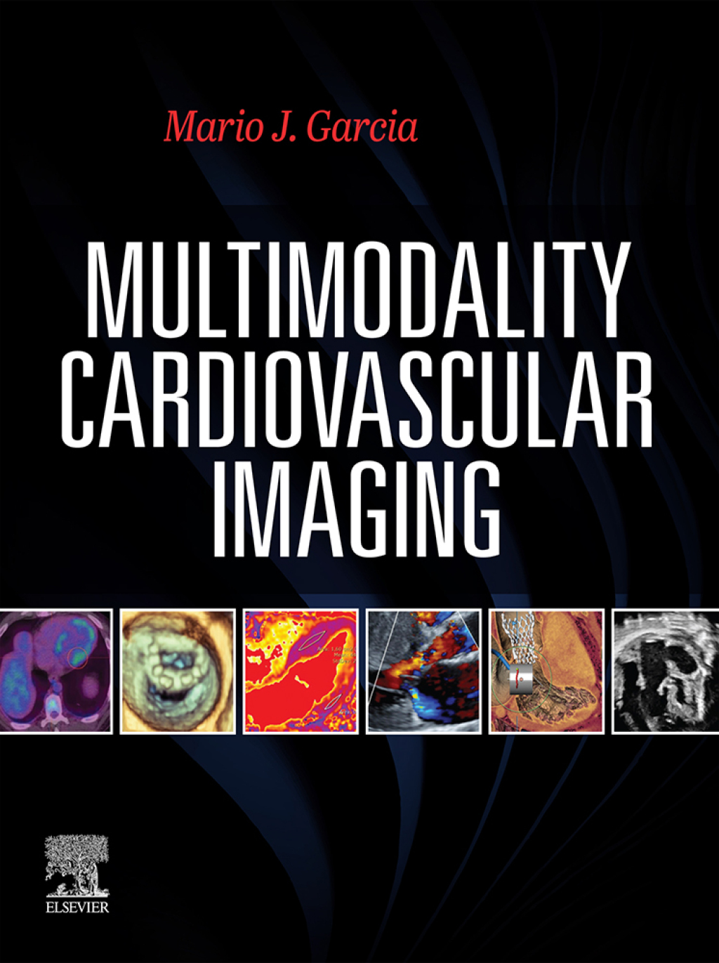 Multimodal Cardiac Imaging (Original PDF from Publisher)