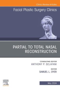 Partial to Total Nasal Reconstruction, An Issue of Facial Plastic Surgery Clinics of North America (True PDF from Publisher)