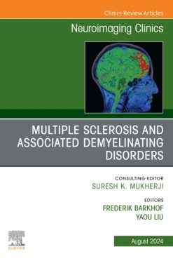 Multiple Sclerosis and Associated Demyelinating Disorders, An Issue of Neuroimaging Clinics of North America (True PDF from Publisher)