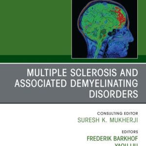 Multiple Sclerosis and Associated Demyelinating Disorders, An Issue of Neuroimaging Clinics of North America (True PDF from Publisher)
