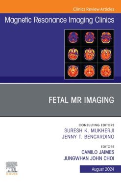 Fetal MRI, An Issue of Magnetic Resonance Imaging Clinics of North America (True PDF from Publisher)