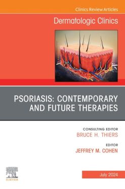 Psoriasis: Contemporary and Future Therapies, An Issue of Dermatologic Clinics (True PDF from Publisher)