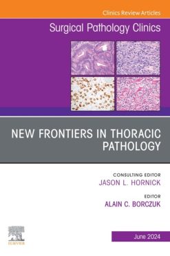 New Frontiers in Thoracic Pathology, An Issue of Surgical Pathology Clinics (True PDF from Publisher)