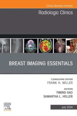 Breast Imaging Essentials, An Issue of Radiologic Clinics of North America (True PDF from Publisher)